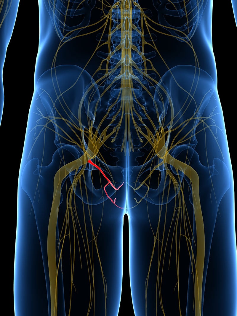 Pudendal Nerve Entrapment: Symptoms, Treatment, and More