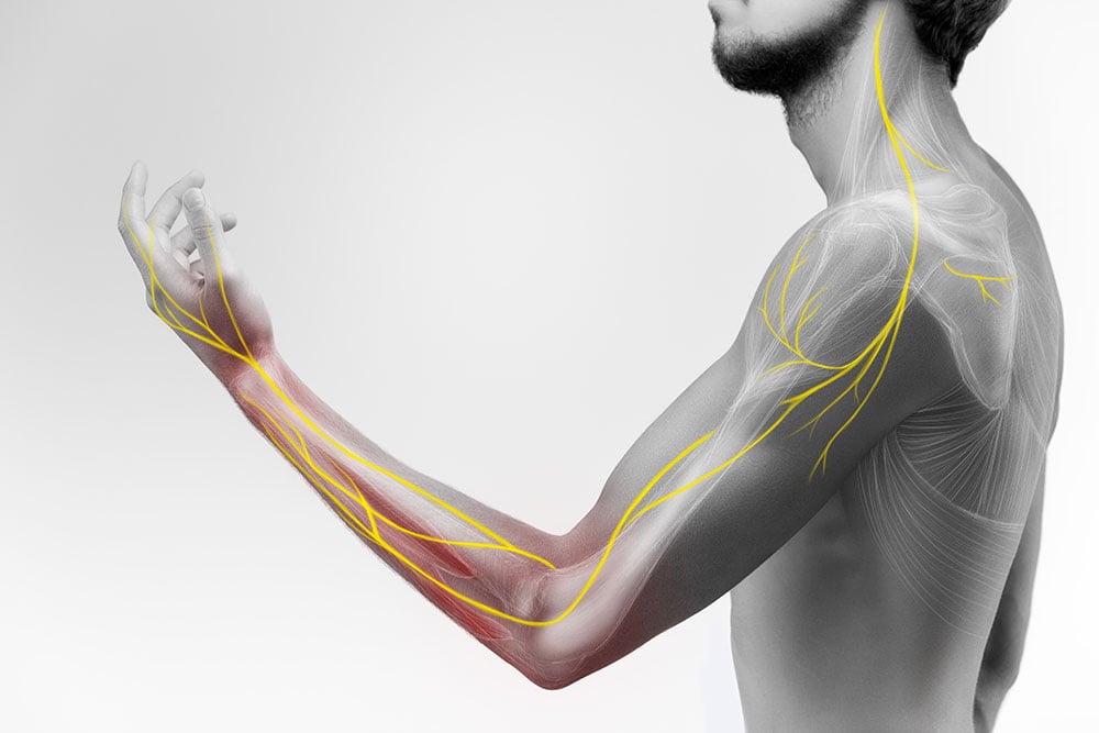 stellate-ganglion-block